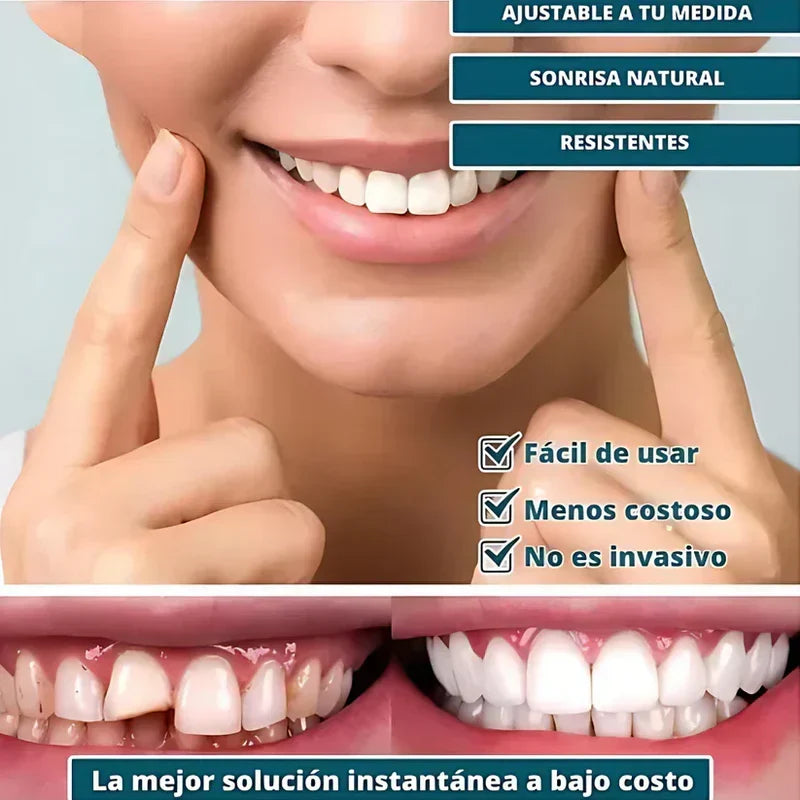 SmilePro - Carillas Dentales Ajustables De Resina + Estuche Regalo  🔥 Oferta Especial 🔥