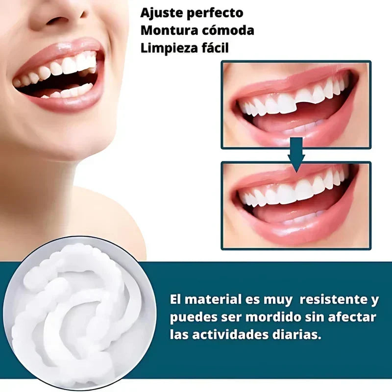 SmilePro - Carillas Dentales Ajustables De Resina + Estuche Regalo  🔥 Oferta Especial 🔥