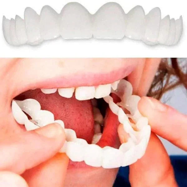 SmilePro - Carillas Dentales Ajustables De Resina + Estuche Regalo  🔥 Oferta Especial 🔥