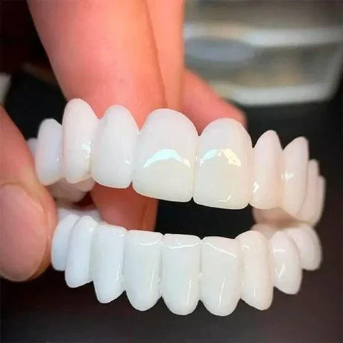 SmilePro - Carillas Dentales Ajustables De Resina + Estuche Regalo  🔥 Oferta Especial 🔥